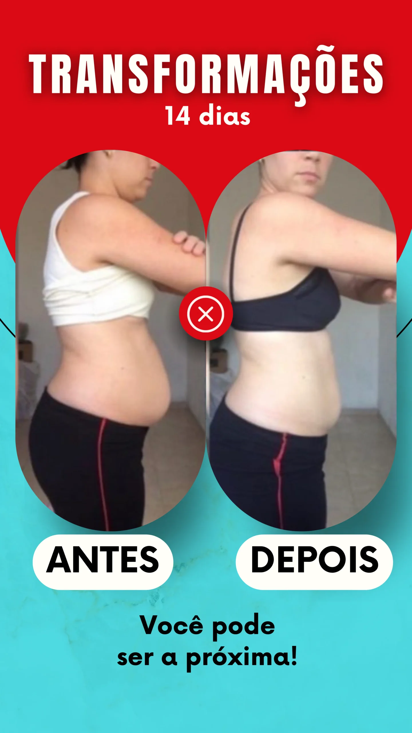 ANTES - 15