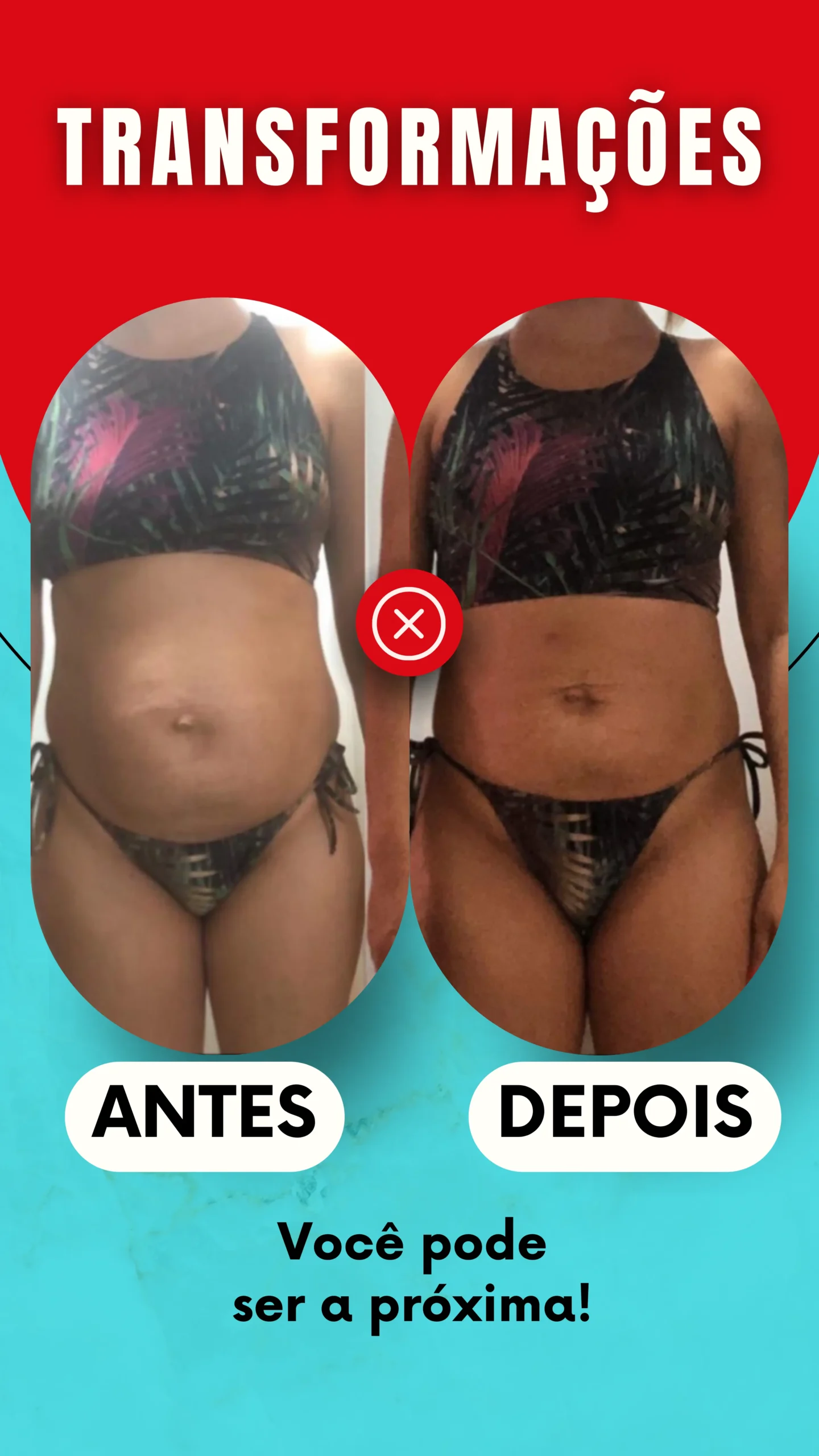 ANTES - 17