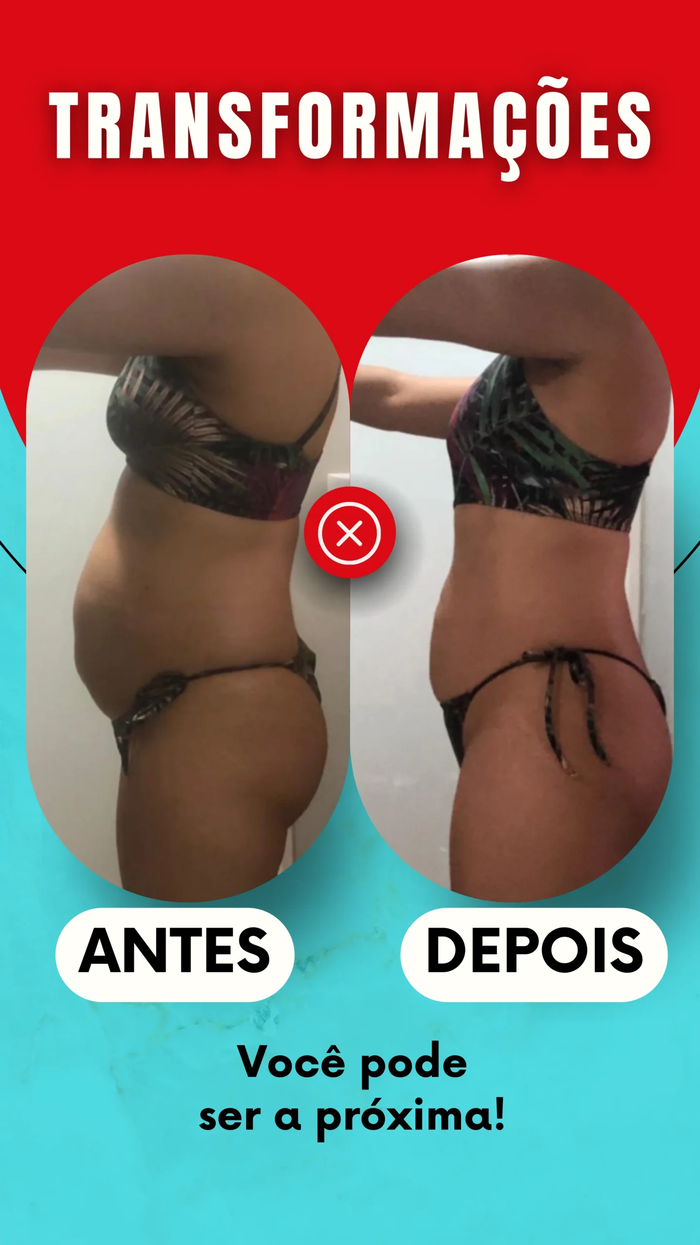ANTES - 18