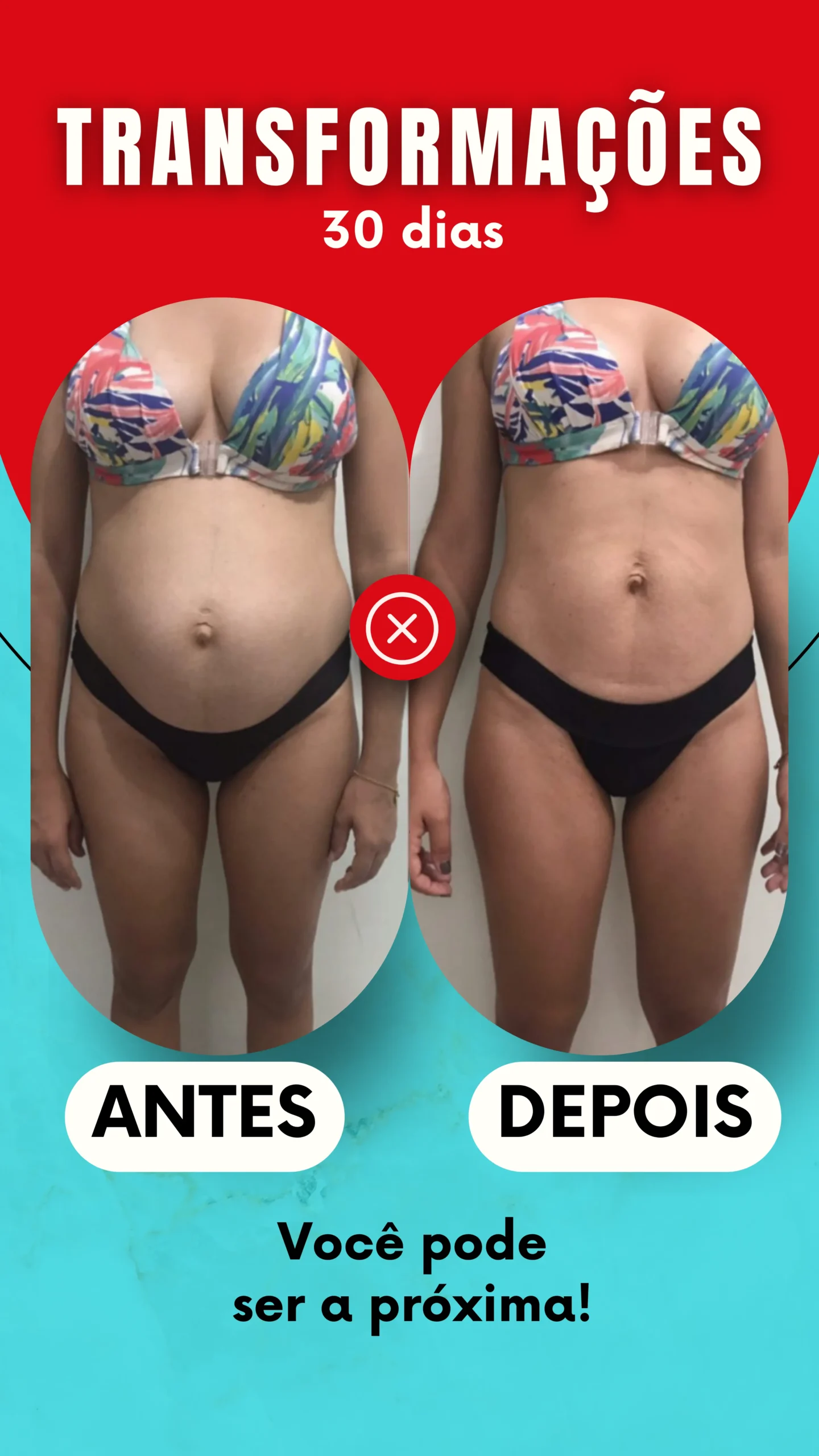 ANTES - 2