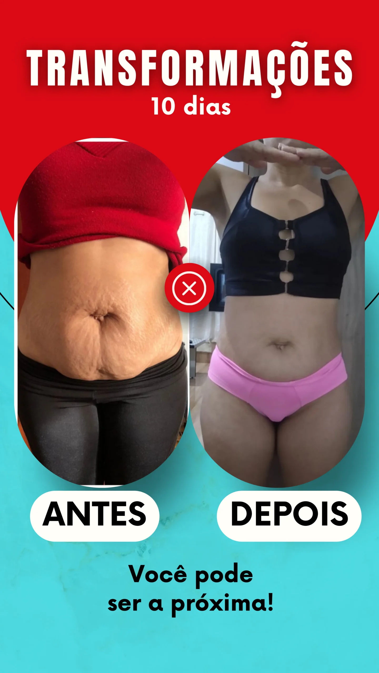 ANTES - 22