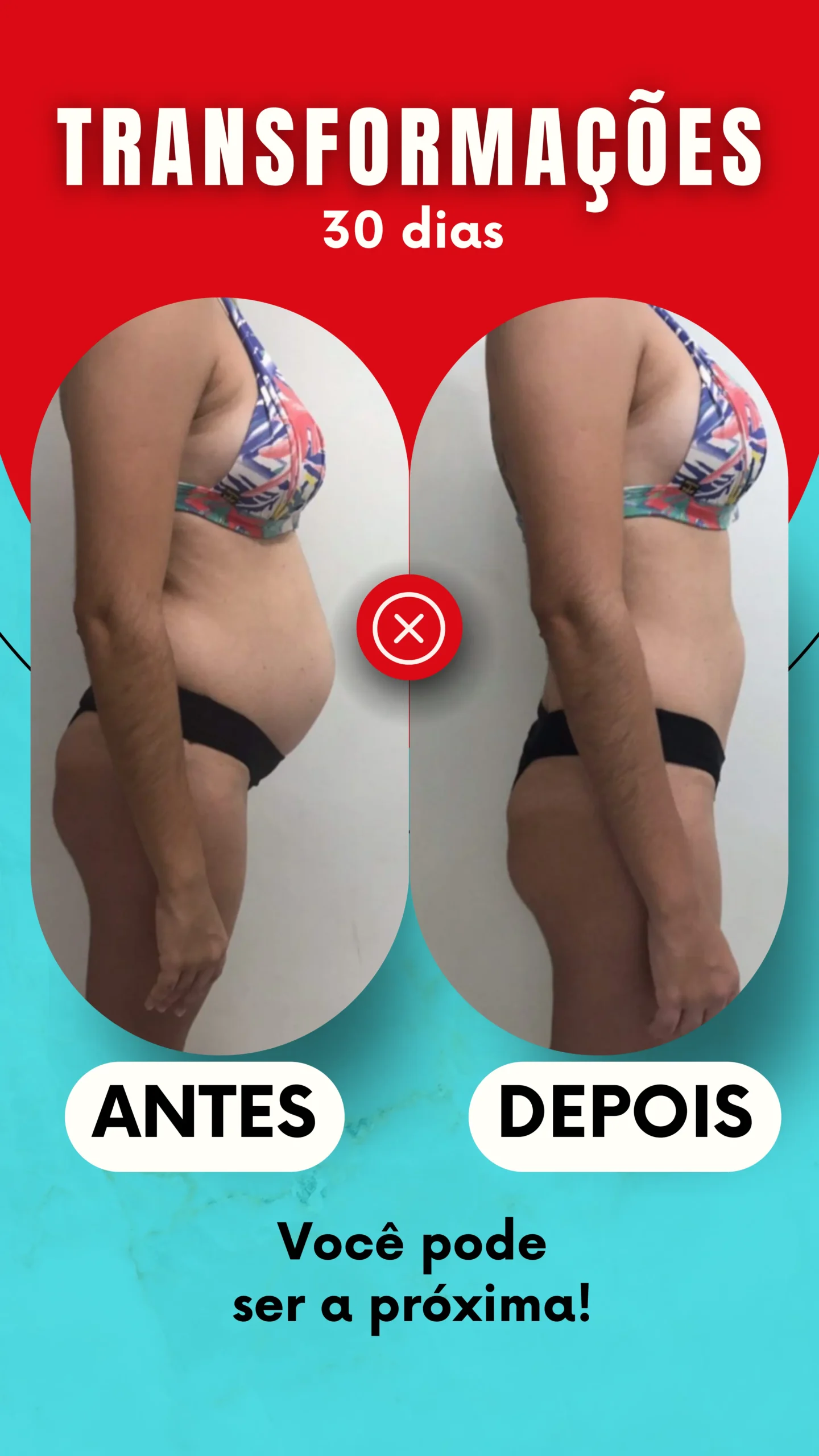ANTES - 3